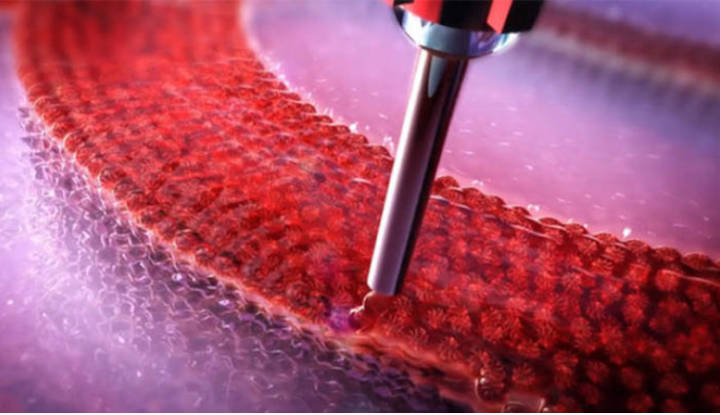 En la impresión 4D han logrado ya reproducir tejido cardíaco de humanos
